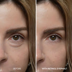 [Day&Night Care] Eyephalt Eyebag Lifting Line